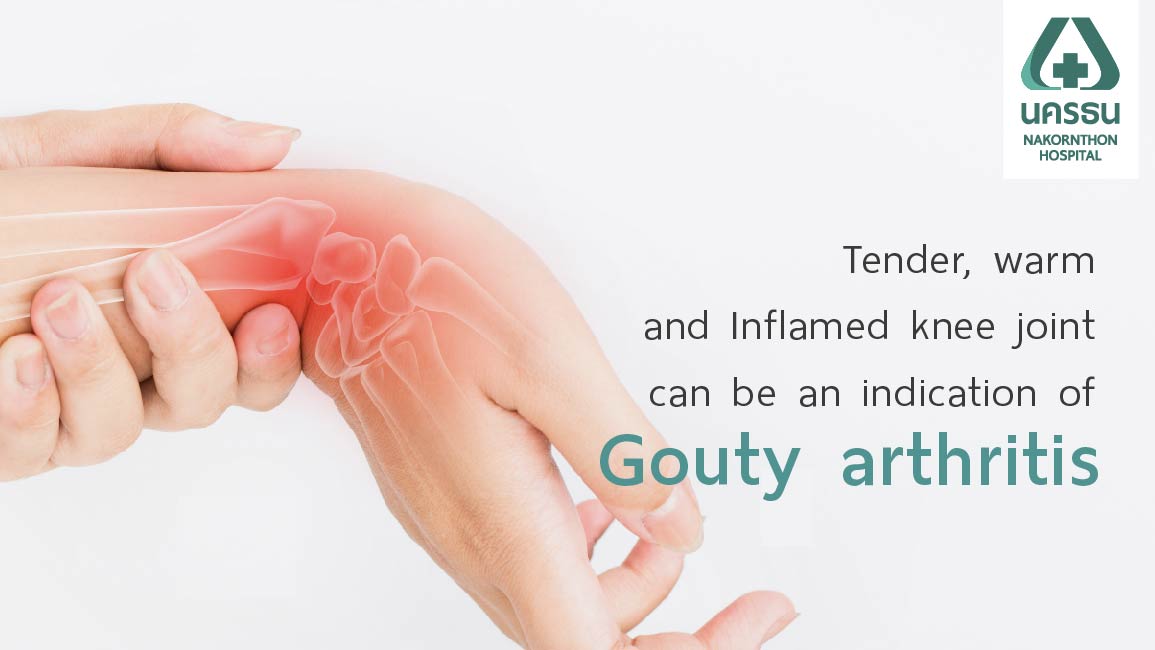 Gout Arthritis signs to look out for